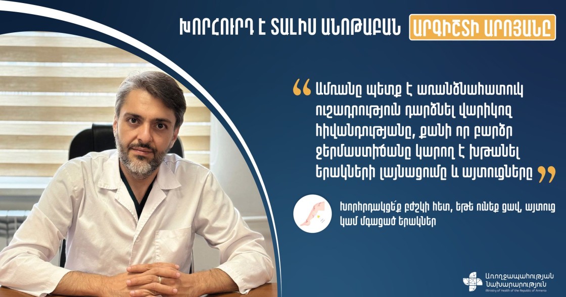 Սառը ջրով լվացե՛ք ոտքերը, պարբերաբար պառկե՛ք ու ոտքերը բարձրացրե՛ք սրտի մակարդակից վեր. ի՞նչ անել վարիկոզի դեպքում. խորհուրդներ՝ բժշկից