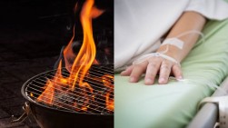 В Арагацотнской области 5-летний ребёнок облил бензином мангал для шашлыка и поджёг его, получив ожоги
