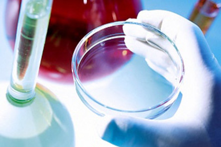 Health Ministry: No cholera cases reported in Armenia 