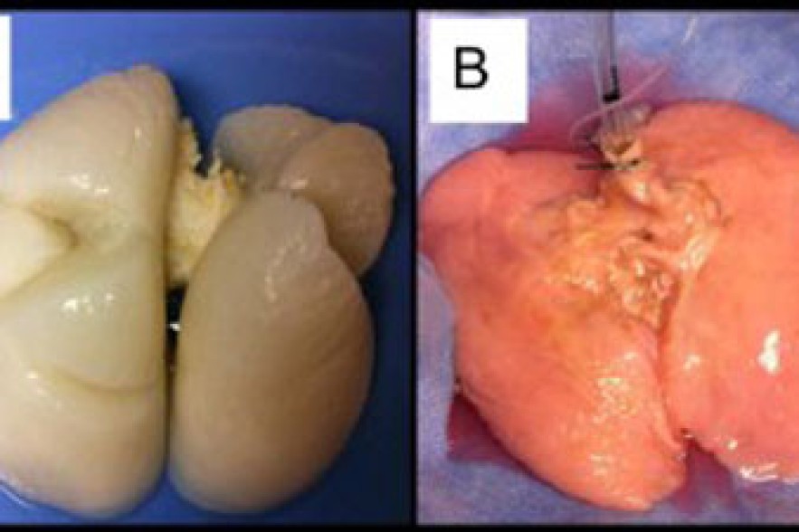 Human lung made in lab for first time