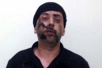 Armenian civilian with health issues may face 20 years in jail in Azerbaijan