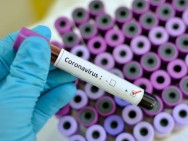 Armenia records 442 new coronavirus cases in a day