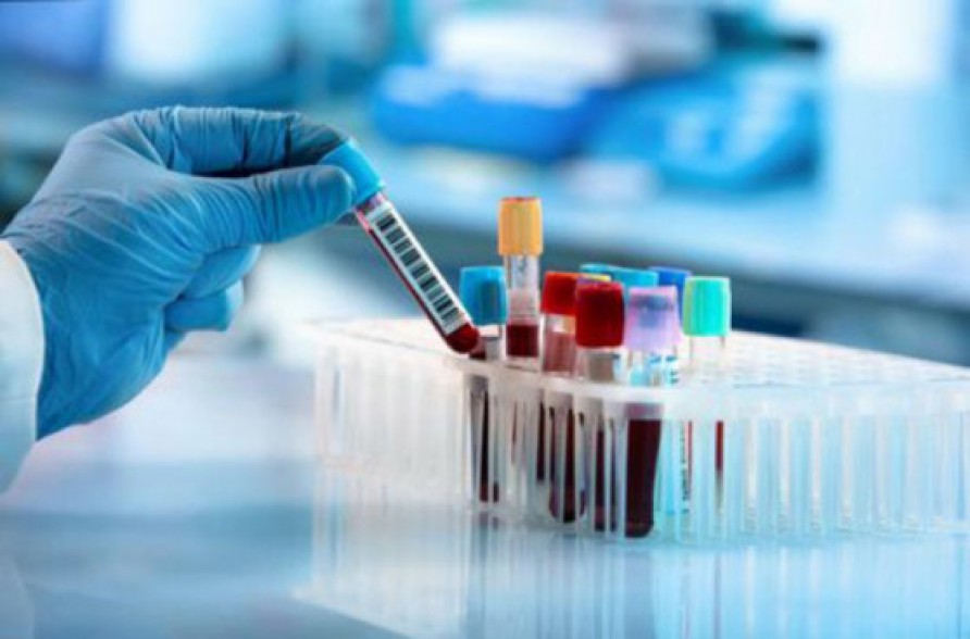 Armenia records 337 new coronavirus cases in a day