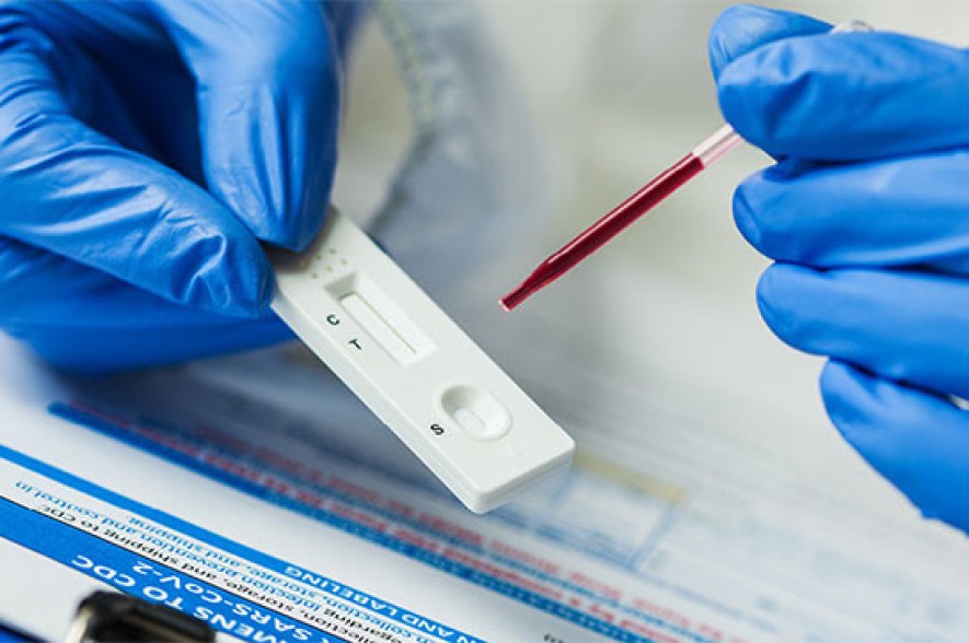Armenia records 748 new coronavirus cases in a day