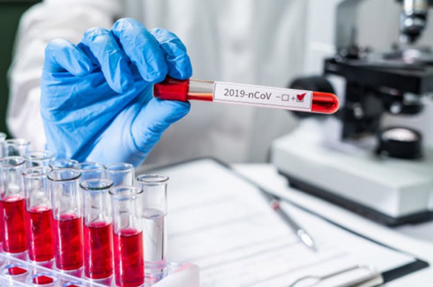 Armenia records 1,071 new coronavirus cases in a day, 16 deaths reported