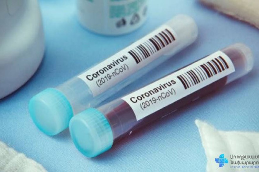 В Армении число зараженных коронавирусом увеличилось на 801, скончались 26 человек