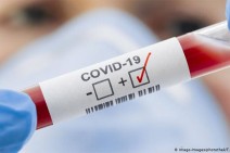 Armenia records 1,094 new coronavirus cases in a day, 21 deaths reported
