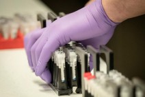Armenia records 1116 new coronavirus cases in a day, 23 deaths reported