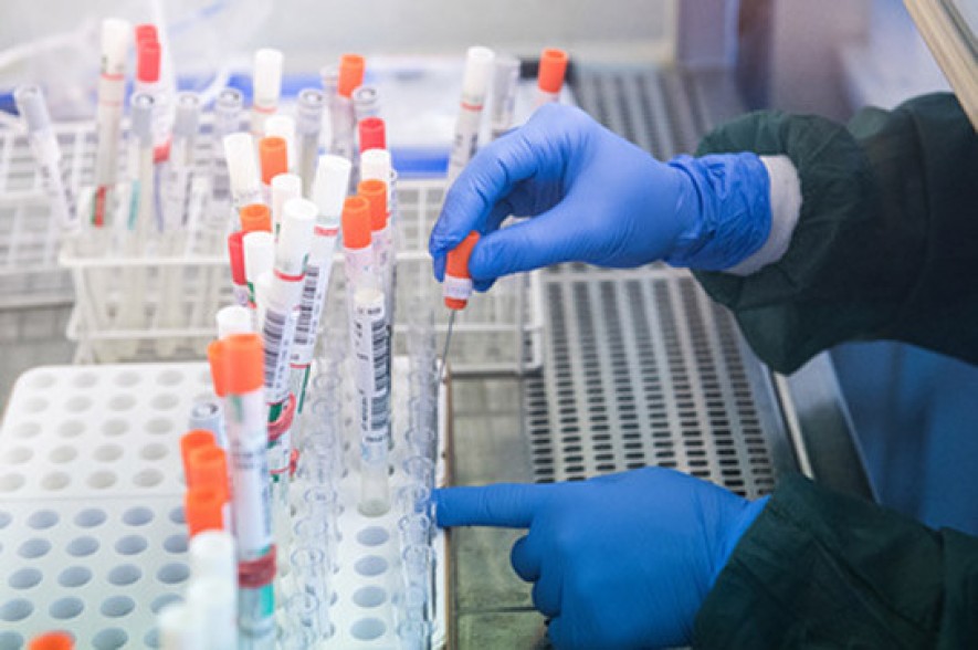 Armenia records 1192 new coronavirus cases in a day, 37 deaths reported