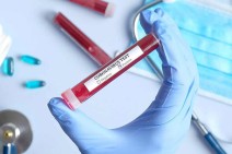 Armenia records 479 new coronavirus cases in a day, 24 deaths reported