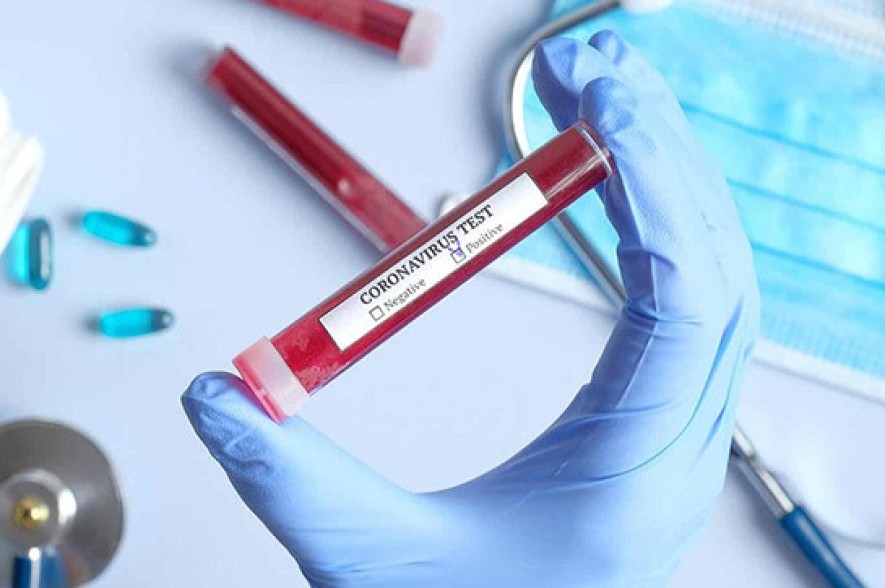 Armenia records 479 new coronavirus cases in a day, 24 deaths reported