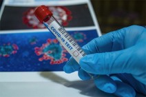 Armenia records 510 new coronavirus cases in a day, 19 deaths reported