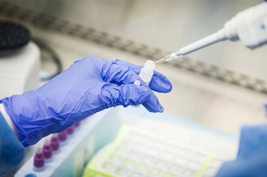 Armenia records 726 new coronavirus cases in a day, 19 deaths reported