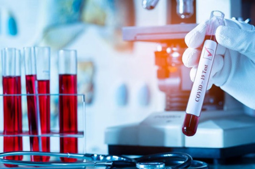 Armenia records 83 new coronavirus cases in a day, 17 deaths reported