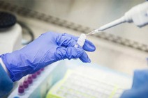 Armenia records 140 new coronavirus cases in a day, 10 deaths reported