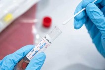 Armenia records 130 new coronavirus cases in a day, 13 deaths reported