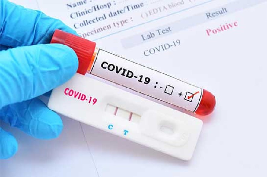 Armenia records 104 new coronavirus cases in a day, 9 deaths reported