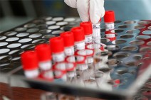 Five new cases of coronavirus reported in Artsakh