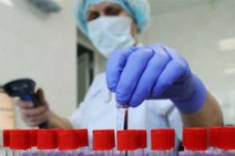 Armenia documents 93 new coronavirus cases in 24 hours, 2 deaths recorded