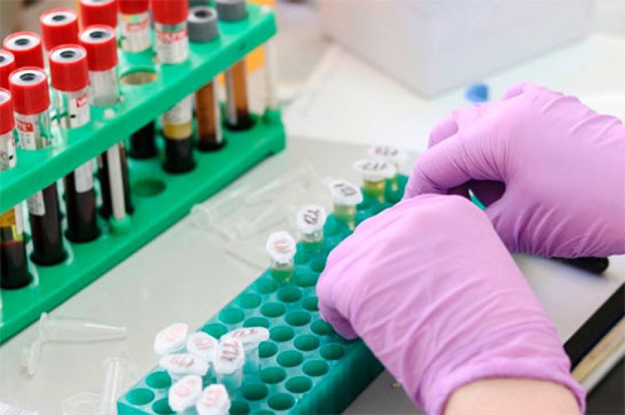 Armenia documents 162 new coronavirus cases in 24 hours, 2 deaths recorded