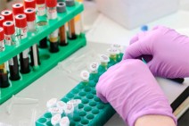 Armenia documents 225 new coronavirus cases in 24 hours, 2 deaths recorded