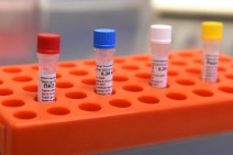 Armenia records 303 coronavirus cases in a day, 4 people died