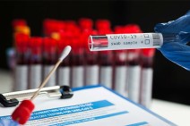 Armenia records 140 coronavirus cases in a day, 3 people died