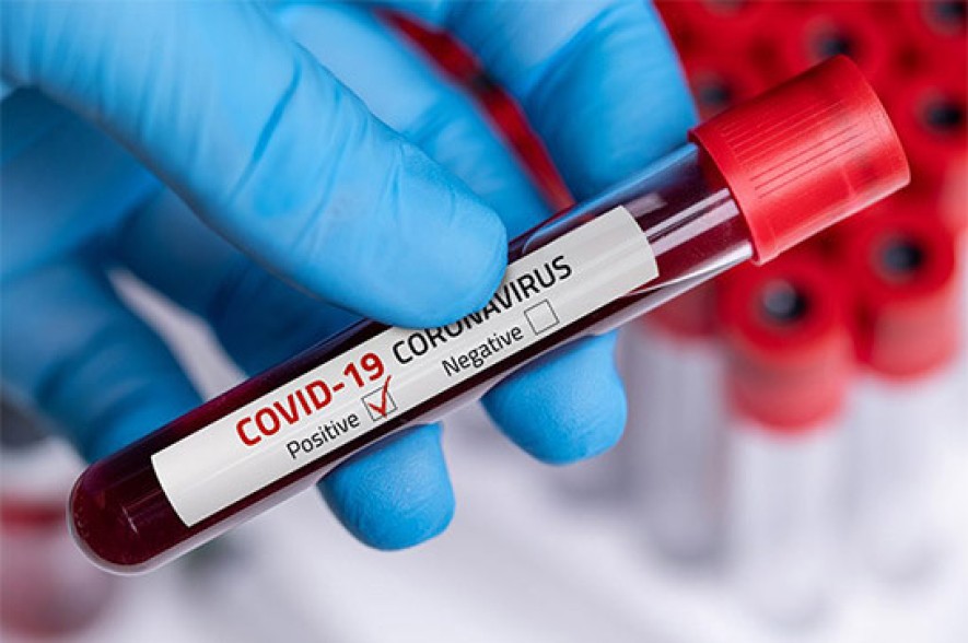 Armenia records 391 coronavirus cases in a day, 7 people died