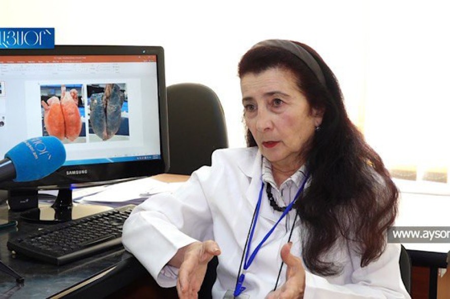Ե՛վ տուբերկուլյոզ, և՛ քաղցկեղ ունեցող հիվանդների 96.4 տոկոսը նախկինում ունեցել է ծխելու բավական մեծ տևականություն. Մասնագետ (Տեսանյութ)