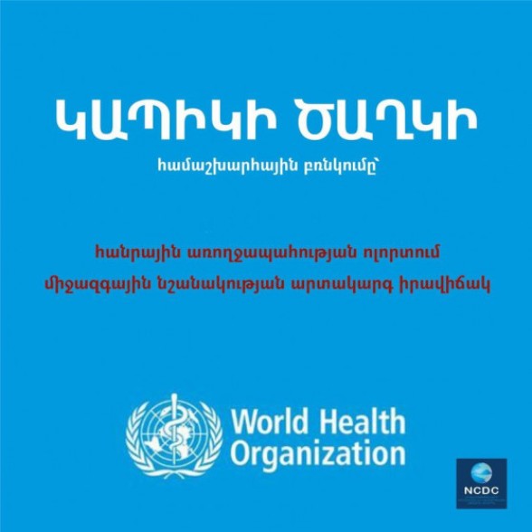 Կարող է ավելի ծանր ընթանալ երեխաների և իմուն համակարգի խնդիրներ ունեցող անձանց շրջանում․ ՀՀ առողջապահության նախարարությունը՝ Կապիկի ծաղիկ հիվանդության իրավիճակի վերաբերյալ
