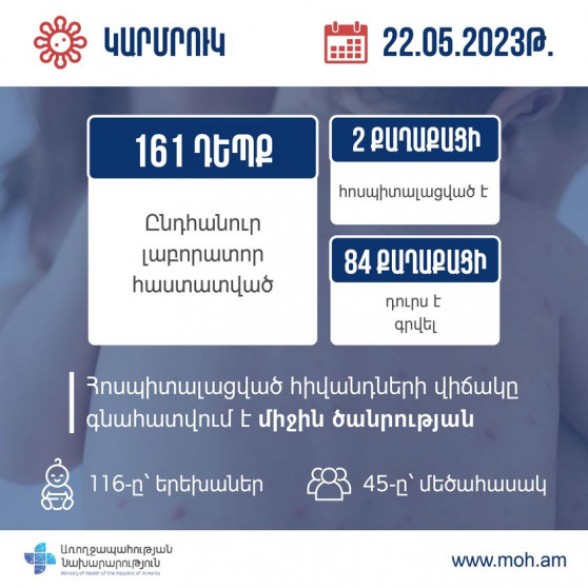 Հայաստանում կարմրուկի լաբորատոր հաստատված դեպքերի թիվը հասել է 161-ի, վարակվածներից 116-ը երեխաներ են