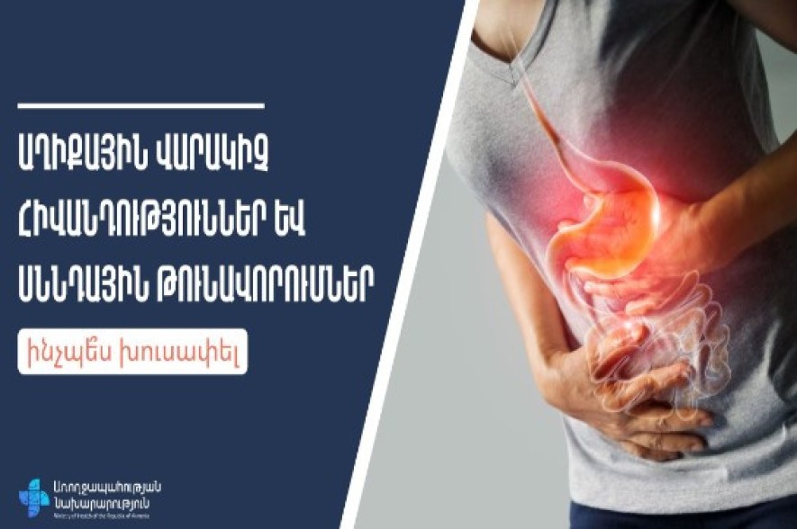 Ինչպես խուսափել աղիքային վարակիչ հիվանդություններից և սննդային թունավորումներից
